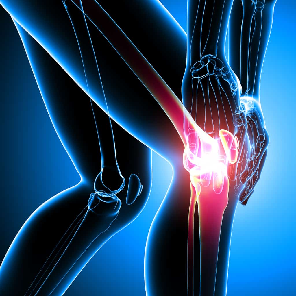 Treating The Arthritic Knee Current Concepts In Rehabilitation Of